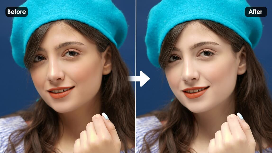 Changement de couleur de peau