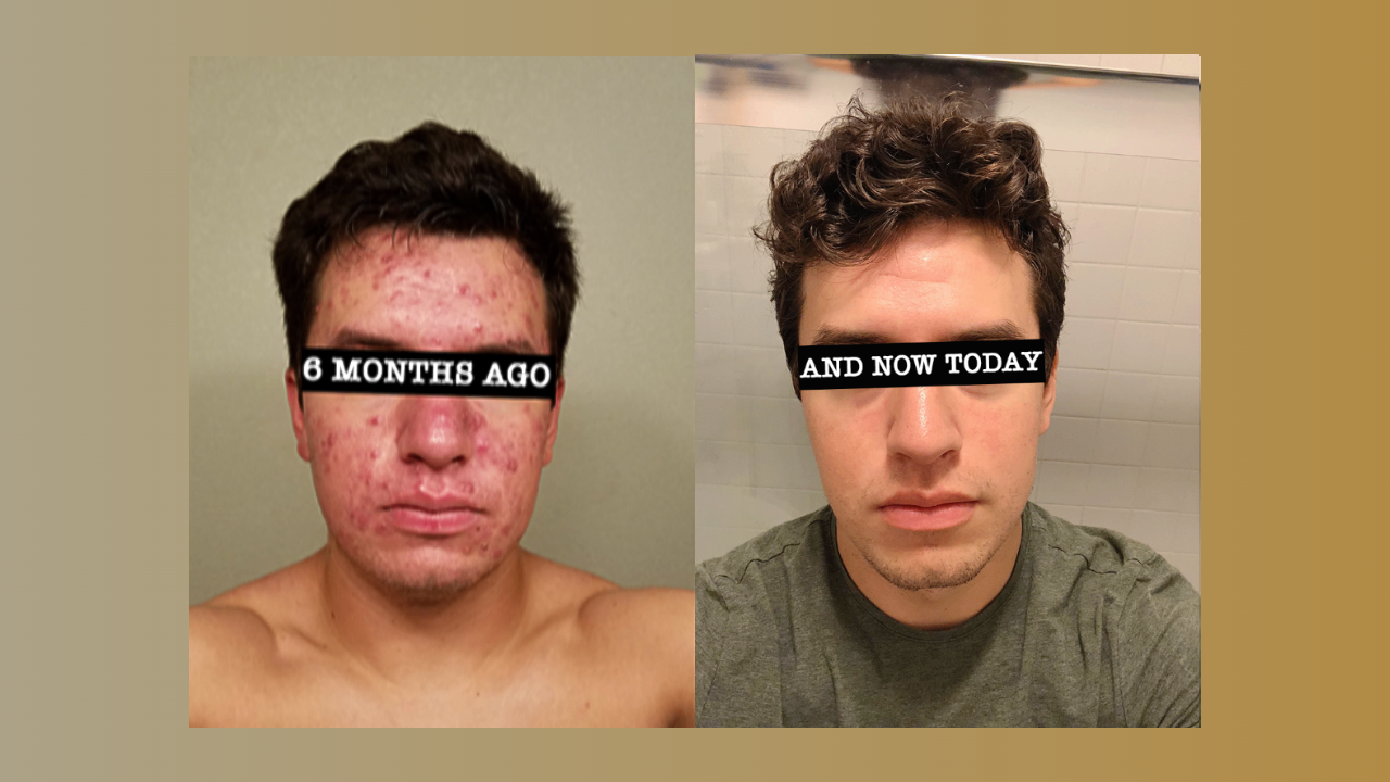 What are before and after ads